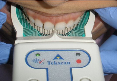 TekScan pic.jpg