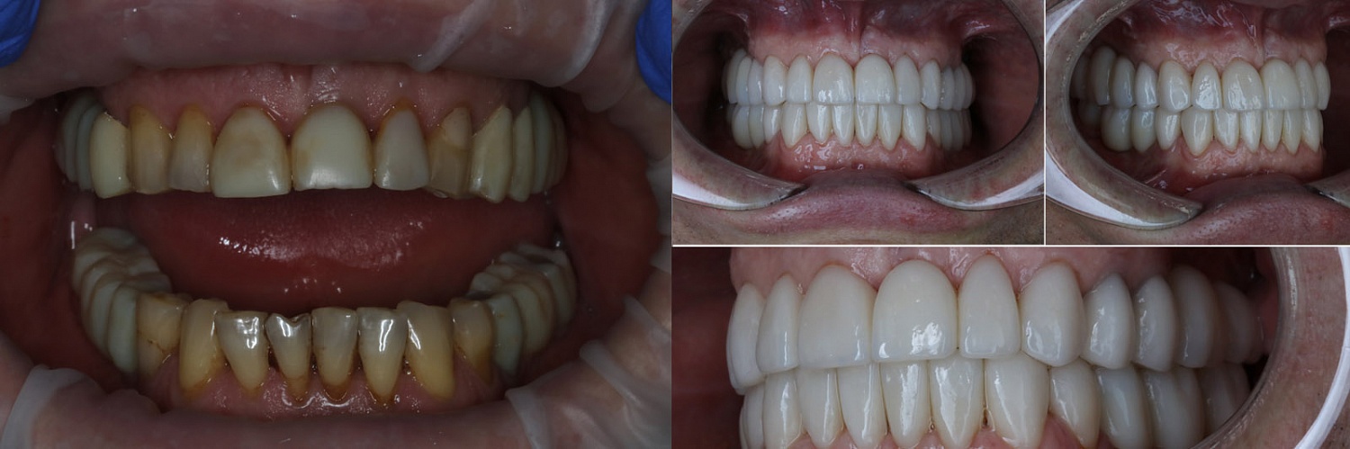 Работы "под ключ"